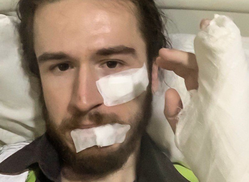 Раненый журналист с перевязанным лицом и рукой в гипсе после нападения. Фото: OCCRP