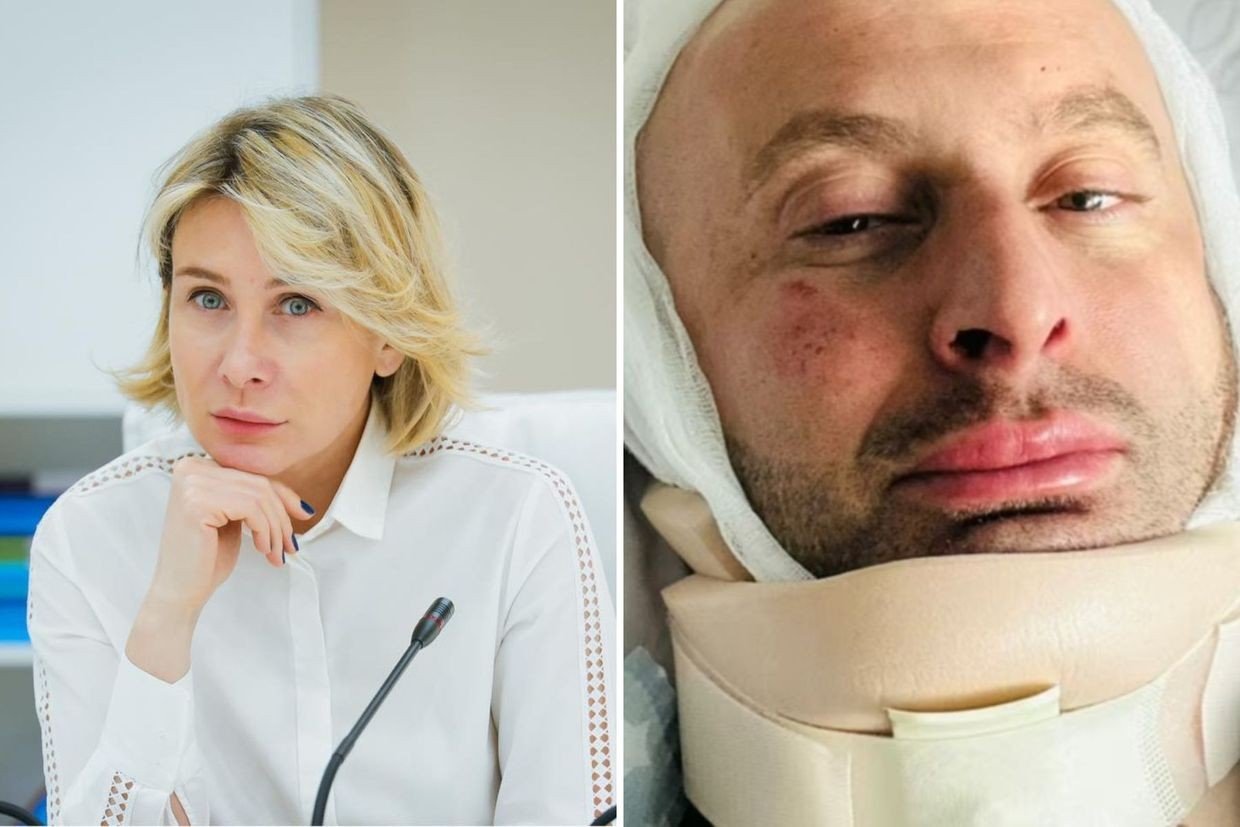 Split image showing female politician and injured activist with neck brace, illustrating human rights violations. Фото: OC Media