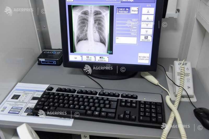 Медицинская рентгеновская станция с рентгенограммой грудной клетки на мониторе в диагностическом кабинете больницы