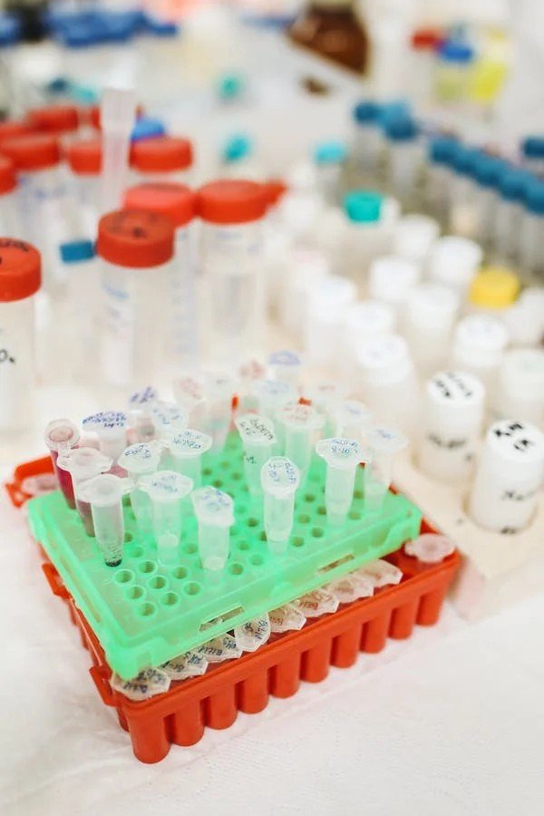 Пробирки с биологическими образцами в штативах медицинской лаборатории — генетические анализы и молекулярная диагностика редких заболеваний