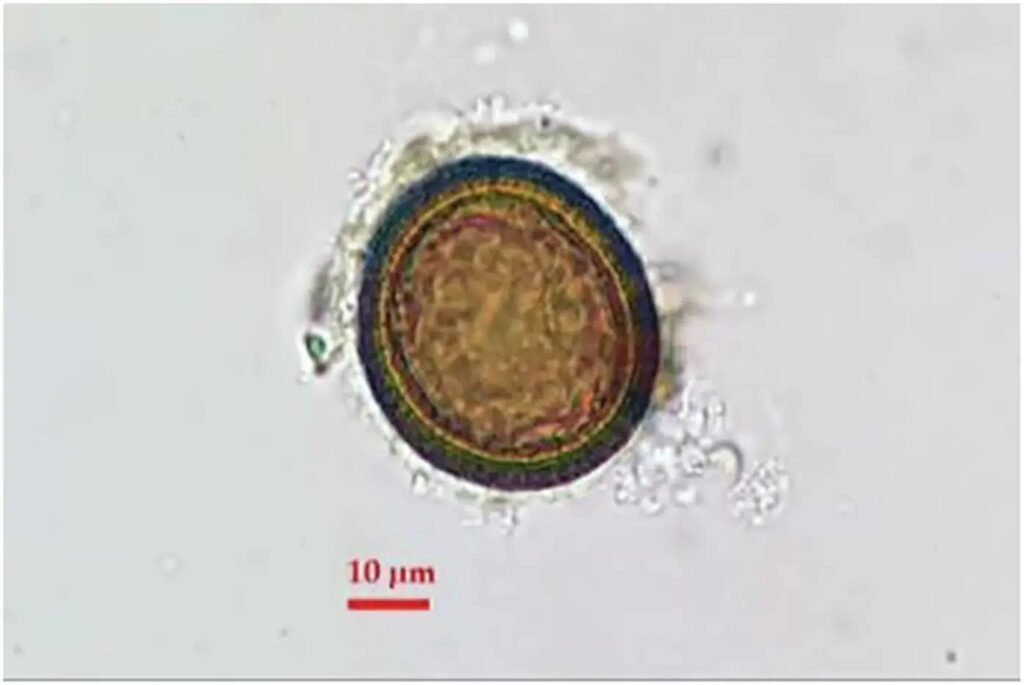 Микрофотография яйца паразита Taenia sp. из римского ночного горшка крепости Новае с масштабной шкалой 10 микрометров